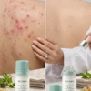 DR. C. TUNA Tea Tree Serum Farmasi 10ml