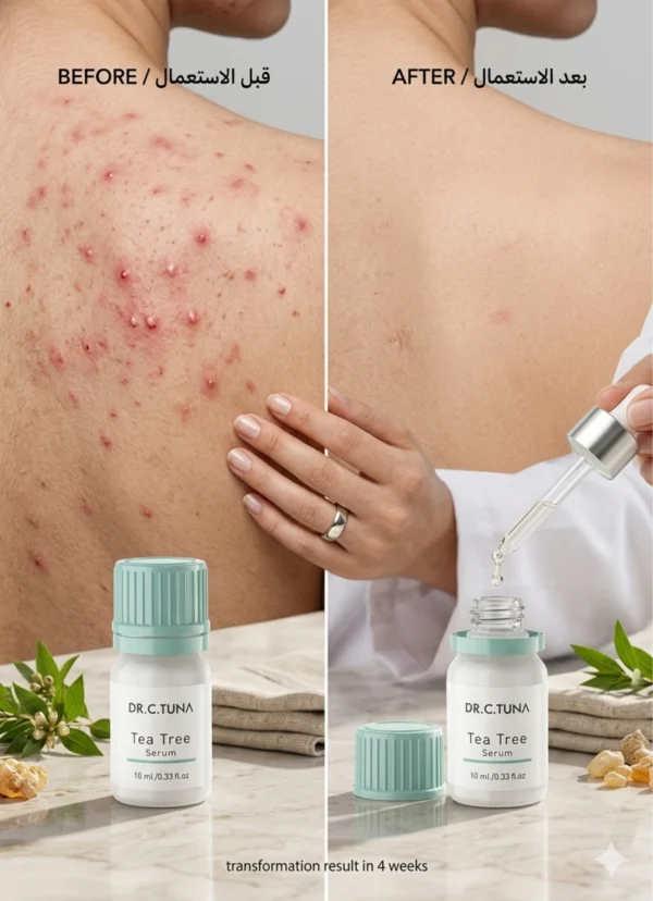 DR. C. TUNA Tea Tree Serum Farmasi 10ml